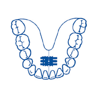 Parafuso Universal