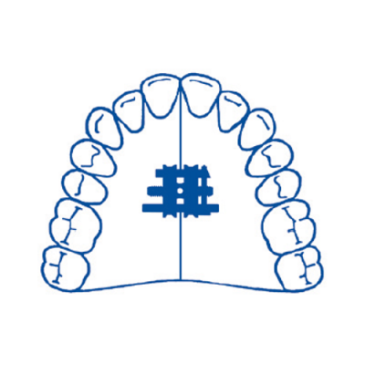 Parafuso Trapezoidal