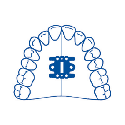 Parafuso Tipo Bi-Leque