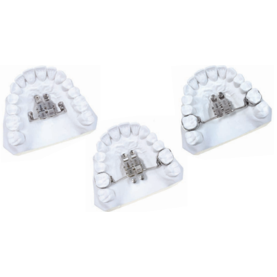 Expansor de Palato para TADs