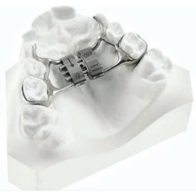 Expansor de Palato Leaf